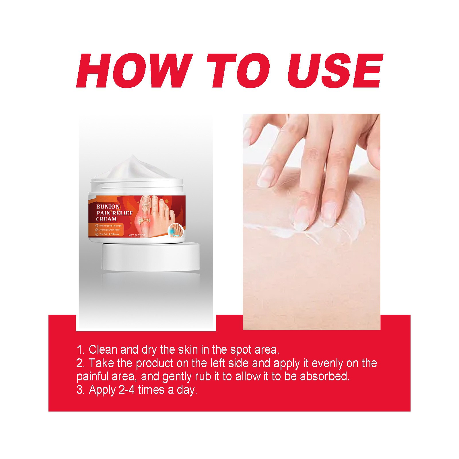 Thumb Bursitis Ointment For Repairing And Correcting Thumb Eversion